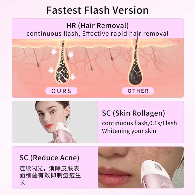 Портативный лазерный эпилятор  – обзор и цена Epilator Wireless